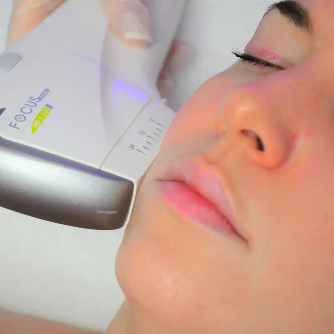 Advanced skin treatments in Teddington. HIFU skin treatment