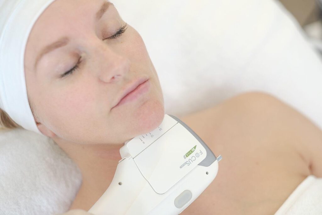 HIFU skin tightening Teddington