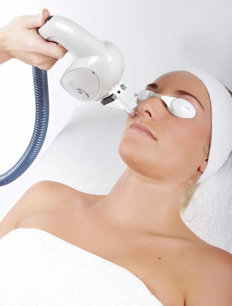 ipl-treatment-teddington IPL treatment Teddington