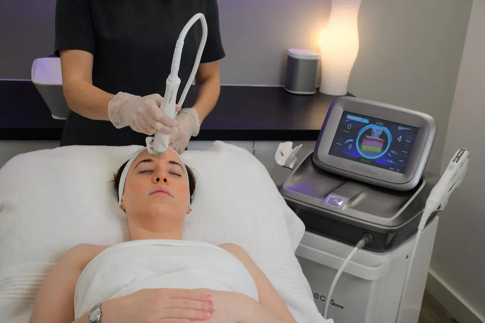 Radiofrequency microneedling in Teddington